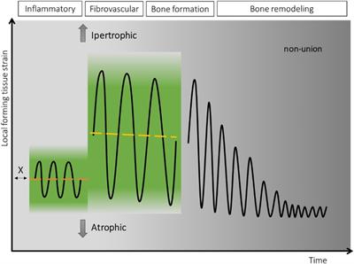 Promoting bone callus formation by taking advantage of the time-dependent fracture gap strain modulation